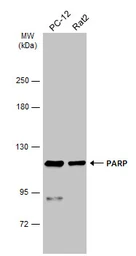 Anti-PARP antibody used in Western Blot (WB). GTX100573