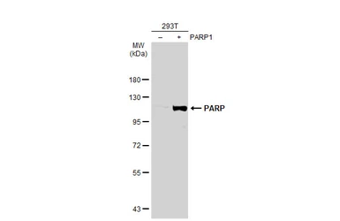 Anti-PARP antibody used in Western Blot (WB). GTX100573