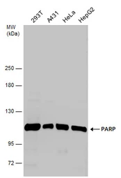 Anti-PARP antibody used in Western Blot (WB). GTX100573