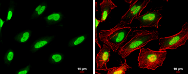 Anti-PARP antibody used in Immunocytochemistry/ Immunofluorescence (ICC/IF). GTX100573