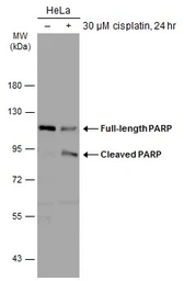 Anti-PARP antibody used in Western Blot (WB). GTX100573