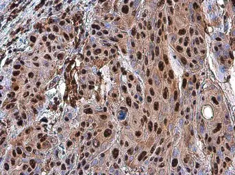 Anti-PARP antibody used in IHC (Paraffin sections) (IHC-P). GTX100573