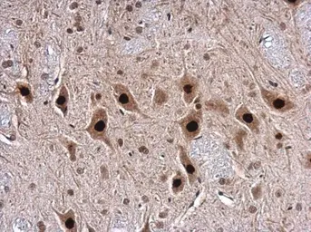 Anti-TDP43 antibody used in IHC (Paraffin sections) (IHC-P). GTX100579