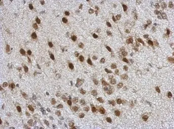 Anti-TDP43 antibody used in IHC (Paraffin sections) (IHC-P). GTX100579