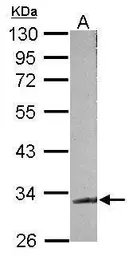 Anti-TDP43 antibody used in Western Blot (WB). GTX100579