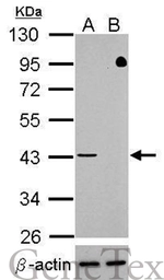 Anti-TDP43 antibody used in Western Blot (WB). GTX100579