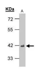 Anti-TDP43 antibody used in Western Blot (WB). GTX100579