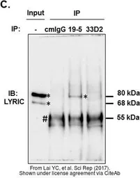 Anti-LYRIC antibody [N2C3] used in Western Blot (WB). GTX100587