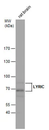 Anti-LYRIC antibody [N2C3] used in Western Blot (WB). GTX100587