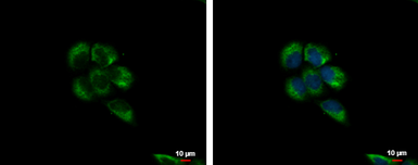 Anti-LYRIC antibody [N2C3] used in Immunocytochemistry/ Immunofluorescence (ICC/IF). GTX100587