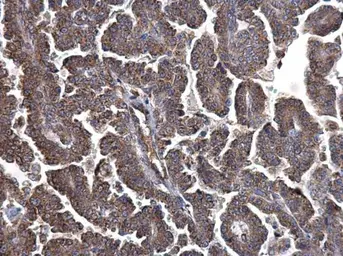 Anti-LYRIC antibody [N2C3] used in IHC (Paraffin sections) (IHC-P). GTX100587