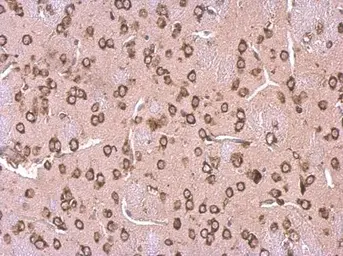 Anti-LYRIC antibody [N2C3] used in IHC (Paraffin sections) (IHC-P). GTX100587