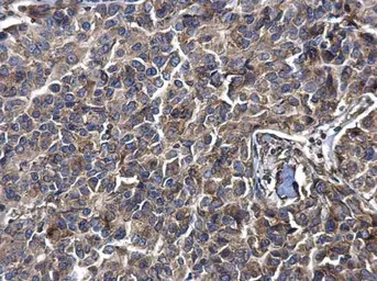 Anti-LYRIC antibody [N2C3] used in IHC (Paraffin sections) (IHC-P). GTX100587