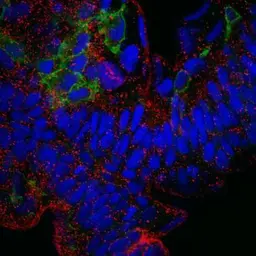 Anti-PTP4A3 antibody [N1C3] used in Western Blot (WB). GTX100600