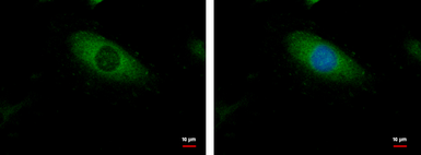 Anti-p130Cas antibody [N2C2], Internal used in Immunocytochemistry/ Immunofluorescence (ICC/IF). GTX100605