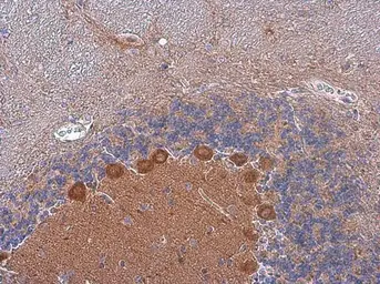 Anti-p130Cas antibody [N2C2], Internal used in IHC (Paraffin sections) (IHC-P). GTX100605