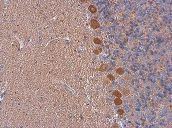 Anti-p130Cas antibody [N2C2], Internal used in IHC (Paraffin sections) (IHC-P). GTX100605