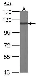 Anti-p130Cas antibody [N2C2], Internal used in Western Blot (WB). GTX100605