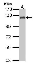 Anti-p130Cas antibody [N2C2], Internal used in Western Blot (WB). GTX100605