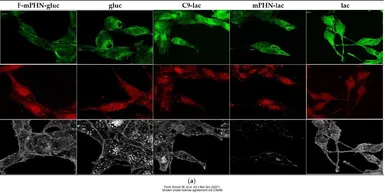 Anti-Vimentin antibody used in Immunocytochemistry/ Immunofluorescence (ICC/IF). GTX100619