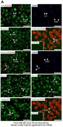 Anti-Vimentin antibody used in IHC (Paraffin sections) (IHC-P). GTX100619