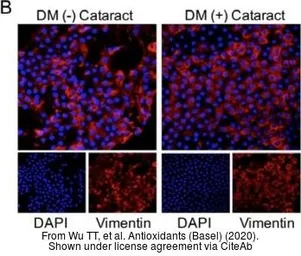 Anti-Vimentin antibody used in Immunohistochemistry (IHC). GTX100619