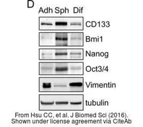 Anti-Vimentin antibody used in Western Blot (WB). GTX100619