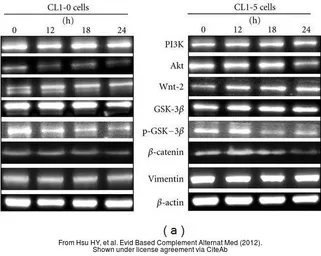 Anti-Vimentin antibody used in Western Blot (WB). GTX100619