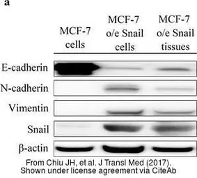 Anti-Vimentin antibody used in Western Blot (WB). GTX100619