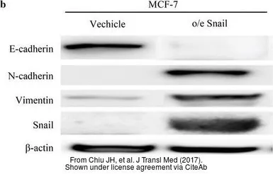 Anti-Vimentin antibody used in Western Blot (WB). GTX100619