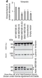 Anti-Vimentin antibody used in Western Blot (WB). GTX100619