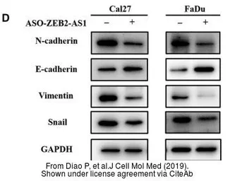 Anti-Vimentin antibody used in Western Blot (WB). GTX100619