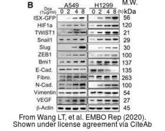 Anti-Vimentin antibody used in Western Blot (WB). GTX100619