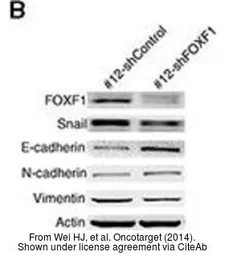 Anti-Vimentin antibody used in Western Blot (WB). GTX100619