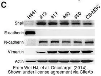 Anti-Vimentin antibody used in Western Blot (WB). GTX100619