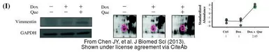 Anti-Vimentin antibody used in Western Blot (WB). GTX100619