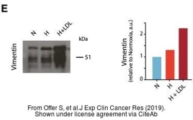 Anti-Vimentin antibody used in Western Blot (WB). GTX100619