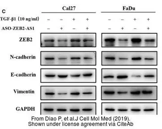 Anti-Vimentin antibody used in Western Blot (WB). GTX100619