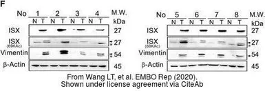 Anti-Vimentin antibody used in Western Blot (WB). GTX100619