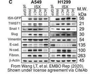 Anti-Vimentin antibody used in Western Blot (WB). GTX100619