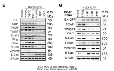 Anti-Vimentin antibody used in Western Blot (WB). GTX100619