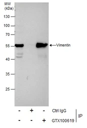 Anti-Vimentin antibody used in Immunoprecipitation (IP). GTX100619