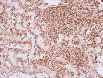 Anti-Vimentin antibody used in IHC (Paraffin sections) (IHC-P). GTX100619