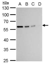 Anti-Vimentin antibody used in Western Blot (WB). GTX100619