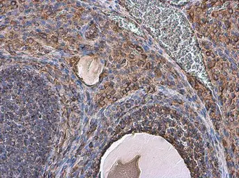 Anti-Vimentin antibody used in IHC (Paraffin sections) (IHC-P). GTX100619