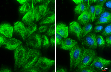 Anti-Vimentin antibody used in Immunocytochemistry/ Immunofluorescence (ICC/IF). GTX100619