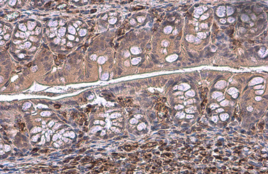 Anti-Vimentin antibody used in IHC (Paraffin sections) (IHC-P). GTX100619