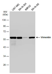 Anti-Vimentin antibody used in Western Blot (WB). GTX100619