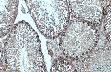 Anti-Vimentin antibody used in IHC (Paraffin sections) (IHC-P). GTX100619