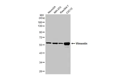 Anti-Vimentin antibody used in Western Blot (WB). GTX100619